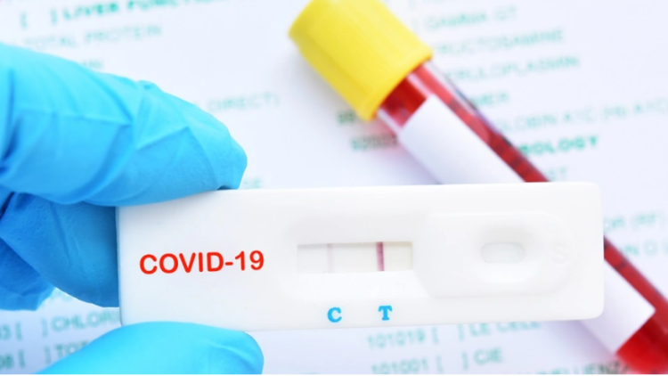 Testet e Covid në Francë do të shiten në supermarkete, shkak përhapja e virusit të ri me shpejtësi