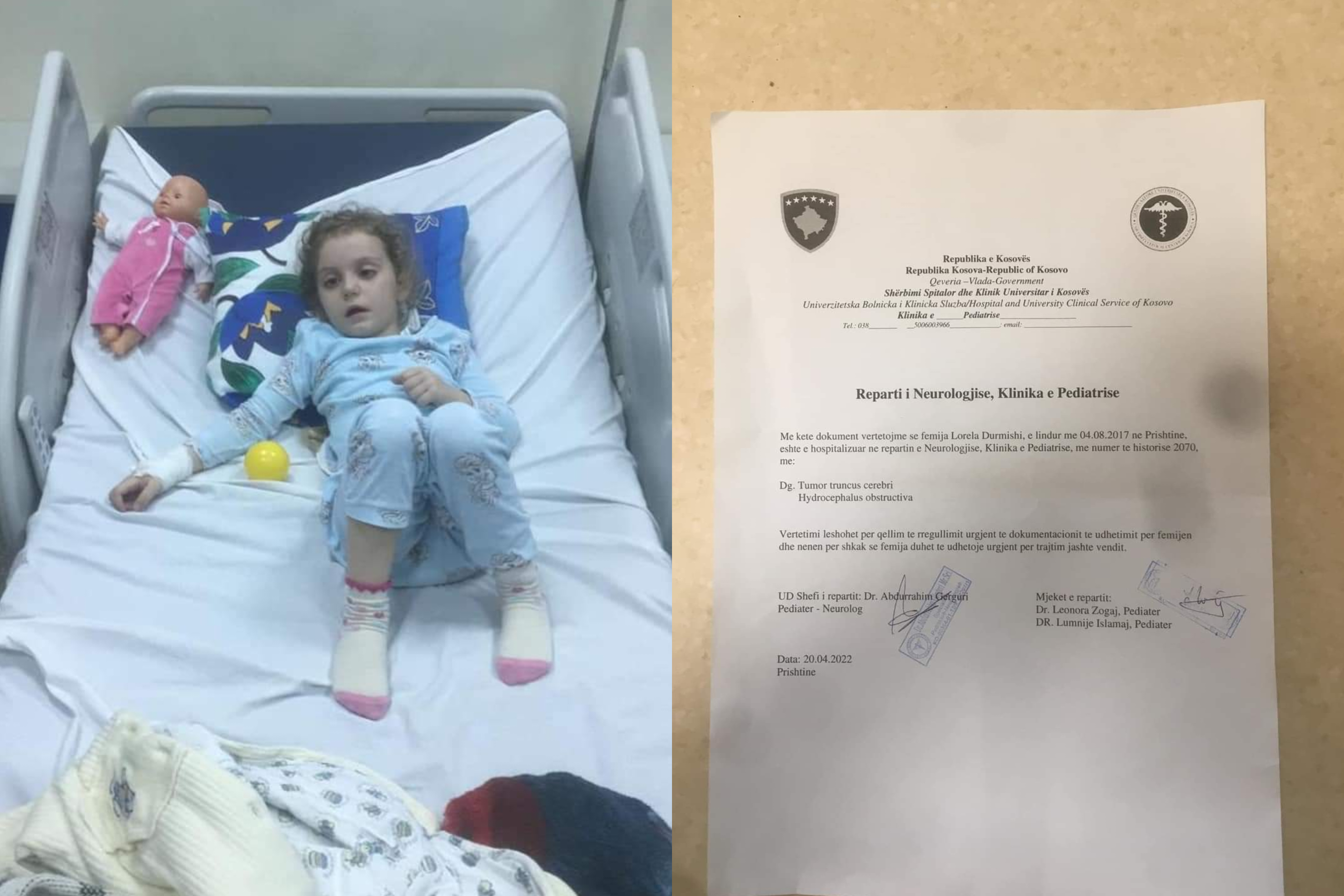 5-vjeçarja në gjendje të rëndë nga tumori në tru, familja kërkon ndihmën e shqiptarëve