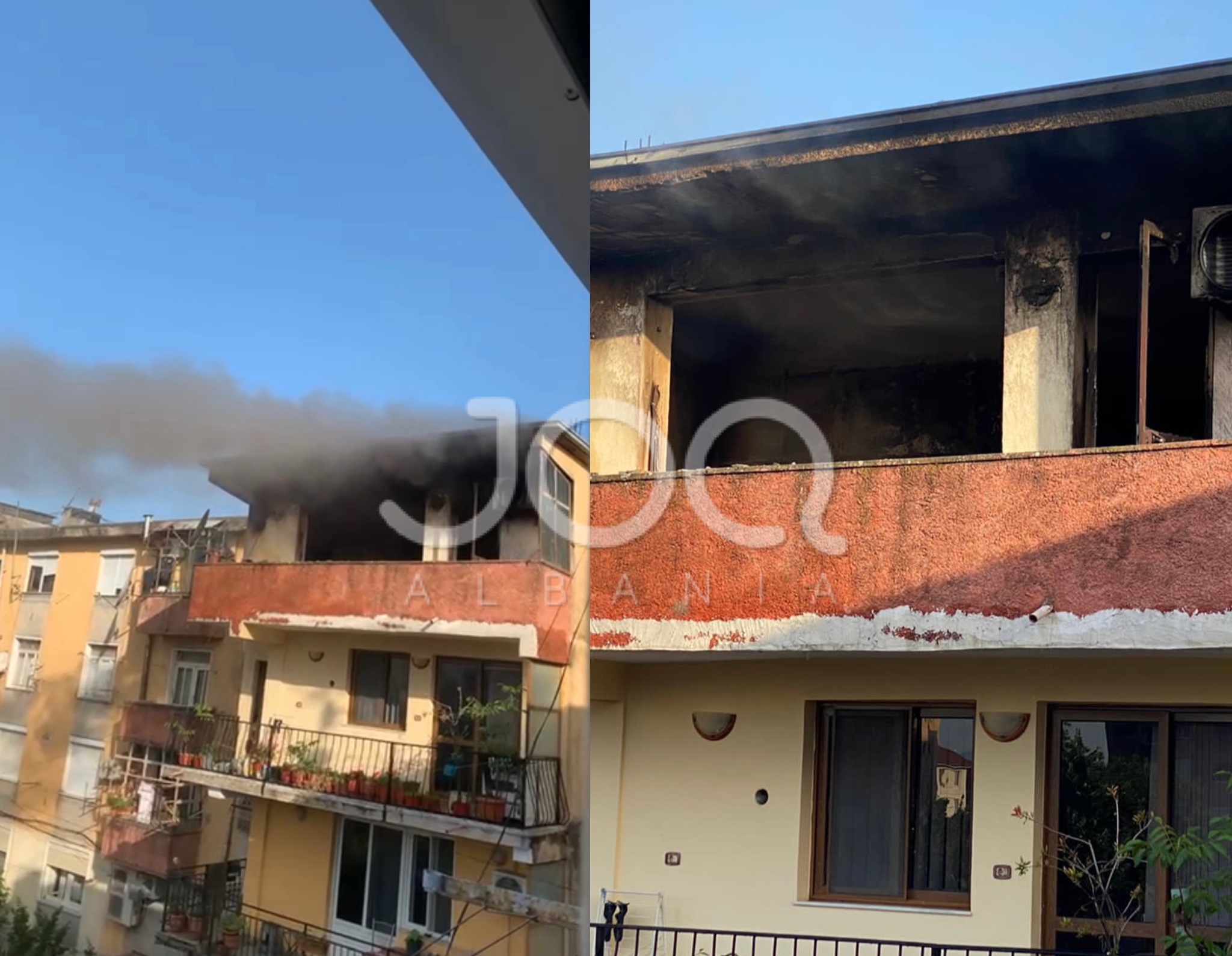 Ambulanca dhe zjarrfikësja dështim në Shkodër: Gjyshi vdes nga vonesa e doktorëve, gjyshja digjet në 50% të trupit nga flakët