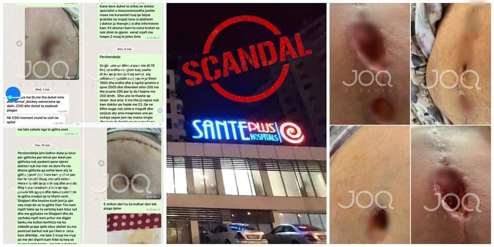 Skandaloze/ Qytetarja “masakrohet” në spitalin SantePlus: Pagova 5 mijë €, m’u hap plaga, doja të vrisja veten!