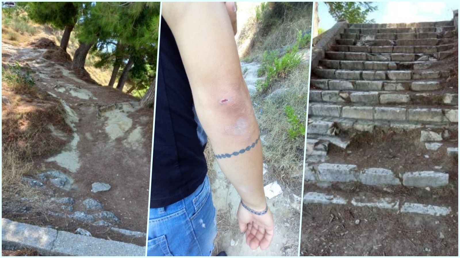 Shkon të vizitojë “Kuzum Baba” në Vlorë, qytetari bie keq nga shkallët dhe dëmton krahun