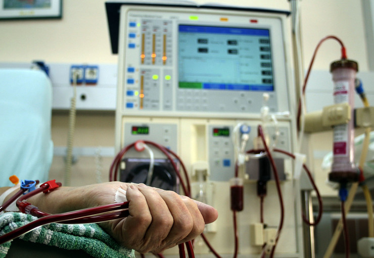 Pacientët me dializë detyrohen të mjekohen privat, mungojnë kushtet
