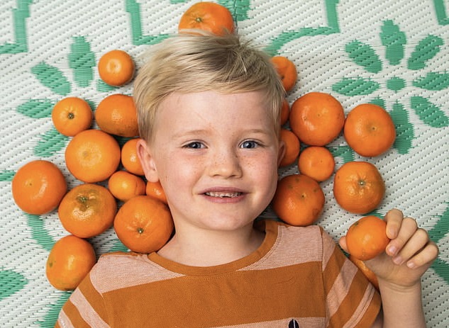 Habiten prindërit: 6-vjeçarit i zverdhet lëkura se hëngri shumë mandarina
