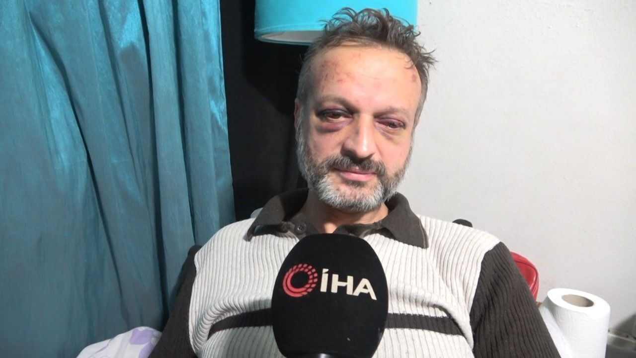 Nuk u plotësoi dëshirën duke mos iu kënduar këngën ‘Çifteteli’, muzikanti turk rrihet për spital nga 9 persona
