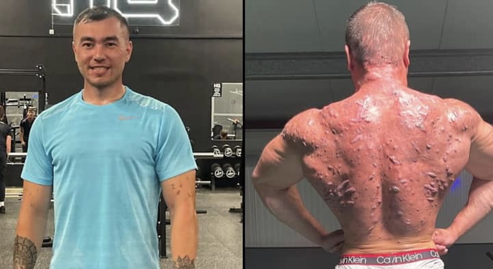 Mbeti 9 muaj në shtëpi, bodybuilder-i tregon pasojat e steroideve në trupin e tij