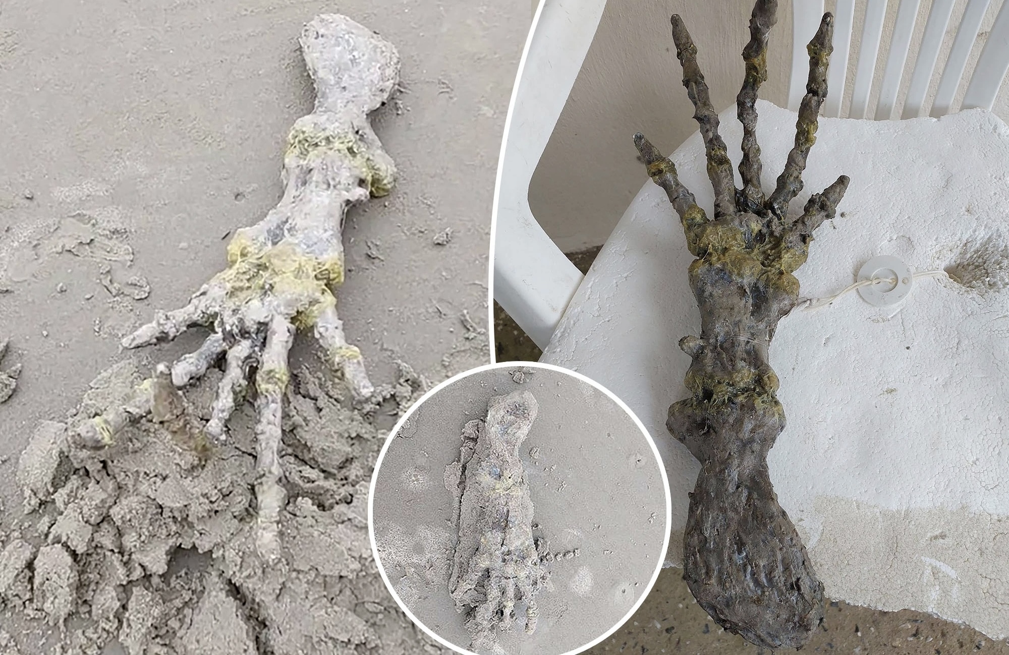 Skeleti i një dore ‘të çuditshme’ gjendet në plazhin brazilian
