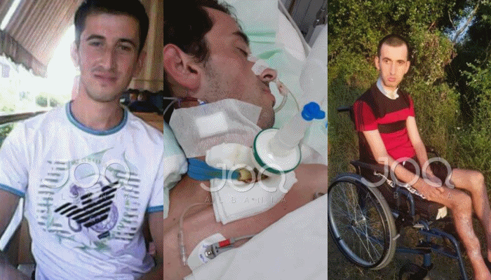 Ka 3 vite që nuk ecën/ 29 vjeçari Elmond ka nevojë për ndihmën e shqiptarëve, kërkon të jetojë si të gjithë shokët e tij