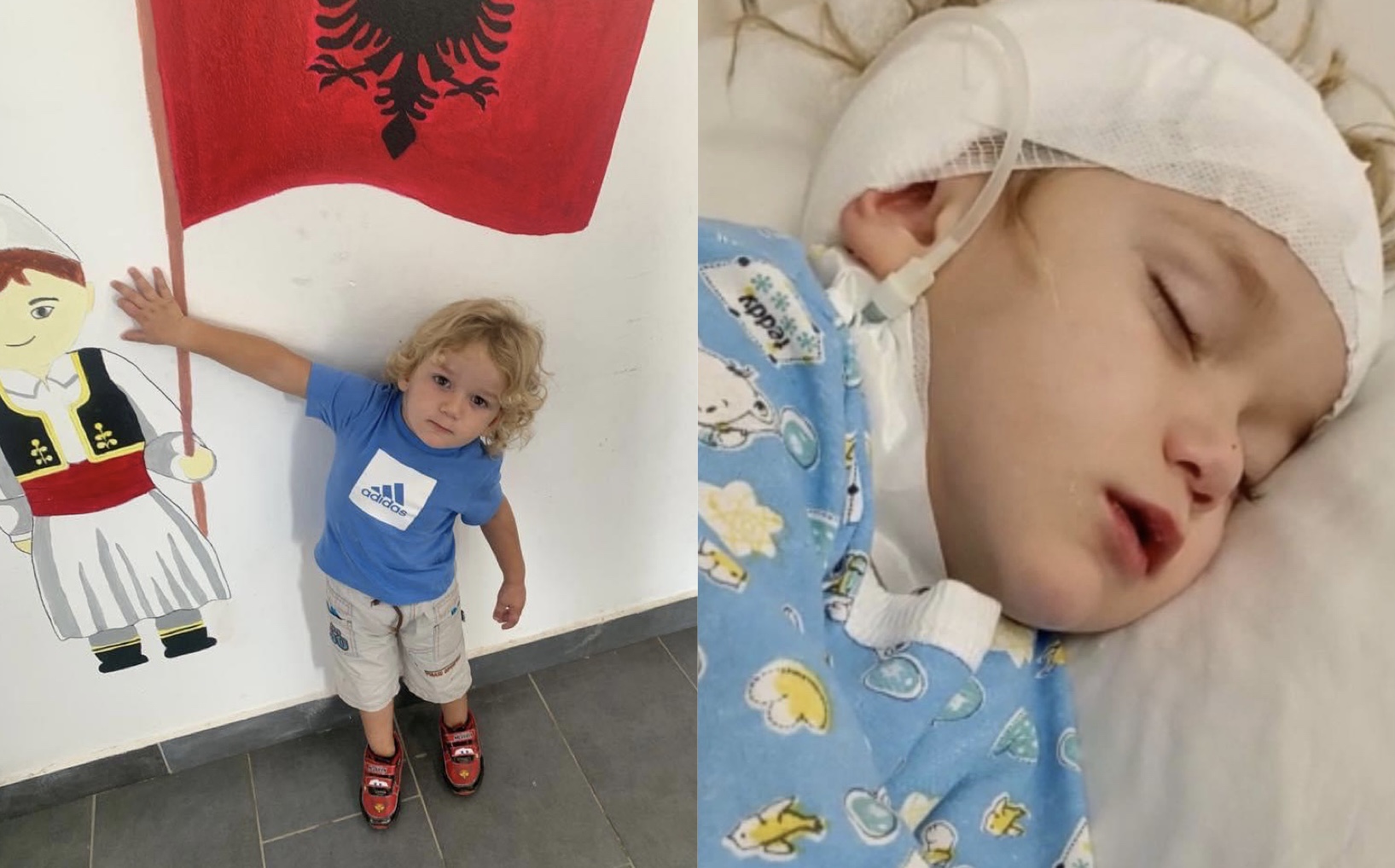 Liami i vogël ka nevojë për ndihmën e shqiptarëve! Kurimi urgjent jashtë shtetit i shpëton jetën