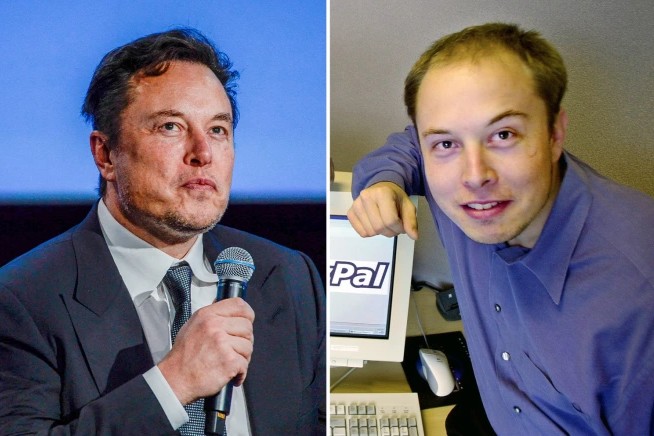 Kirurgu e zbulon: Elon Musk ka shpenzuar 116 mijë paund për t’u dukur më i ri