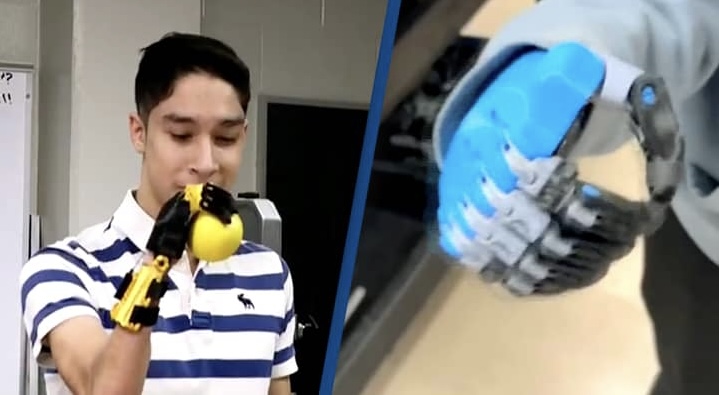 Nxënësit i ndryshojnë jetën shokut të klasës, i ndërtojnë vetë një dorë robotike