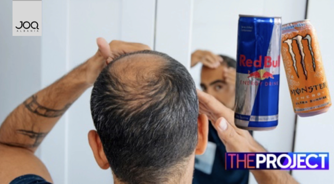 Shkencëtarët: Pirja e pijeve energjike i shkakton meshkujve rënie flokësh