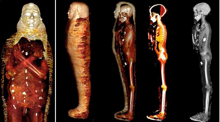 FOTOT/ Shkencëtarët ‘zbërthejnë’ mumjen ‘Golden Boy’, adoleshenti që vdiq 2300 vjet më parë