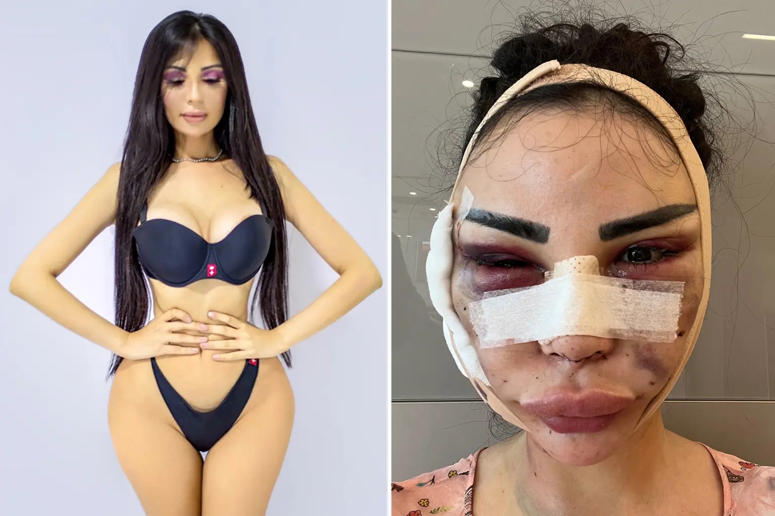 Shpenzoi 600 mijë dollarë për t’u dukur si Kim Kardashian, modelja ndërron mendje: Do i kthehem vetes!