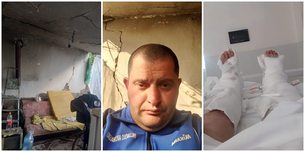 Të zhytur në varfëri, Ernildi me autizëm nga Elbasani kërkon ndihmë për veten dhe nënën e tij të paralizuar