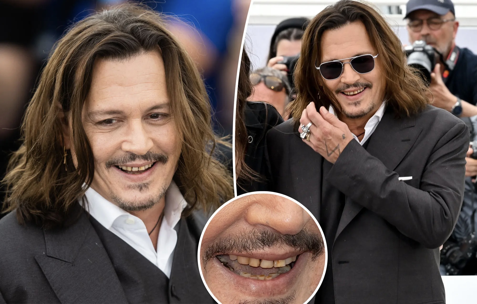 Dhëmbët e “kalbur” të Johnny Depp “neveritin” fansat