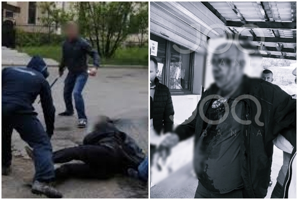 Sherri në Mirditë, 54-vjeçari u dhunua nga 4 vëllezërit