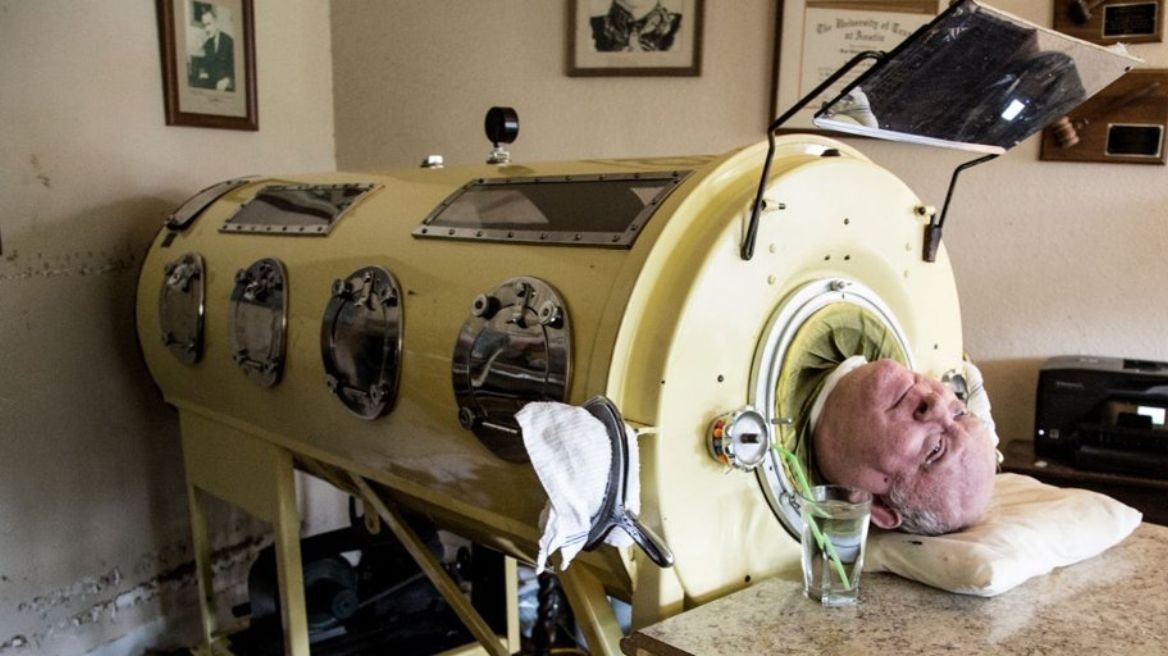 U prek nga poliomeliti kur ishte 6-vjeç, Paul mbijeton 70 vite në një ‘mushkëri hekuri’