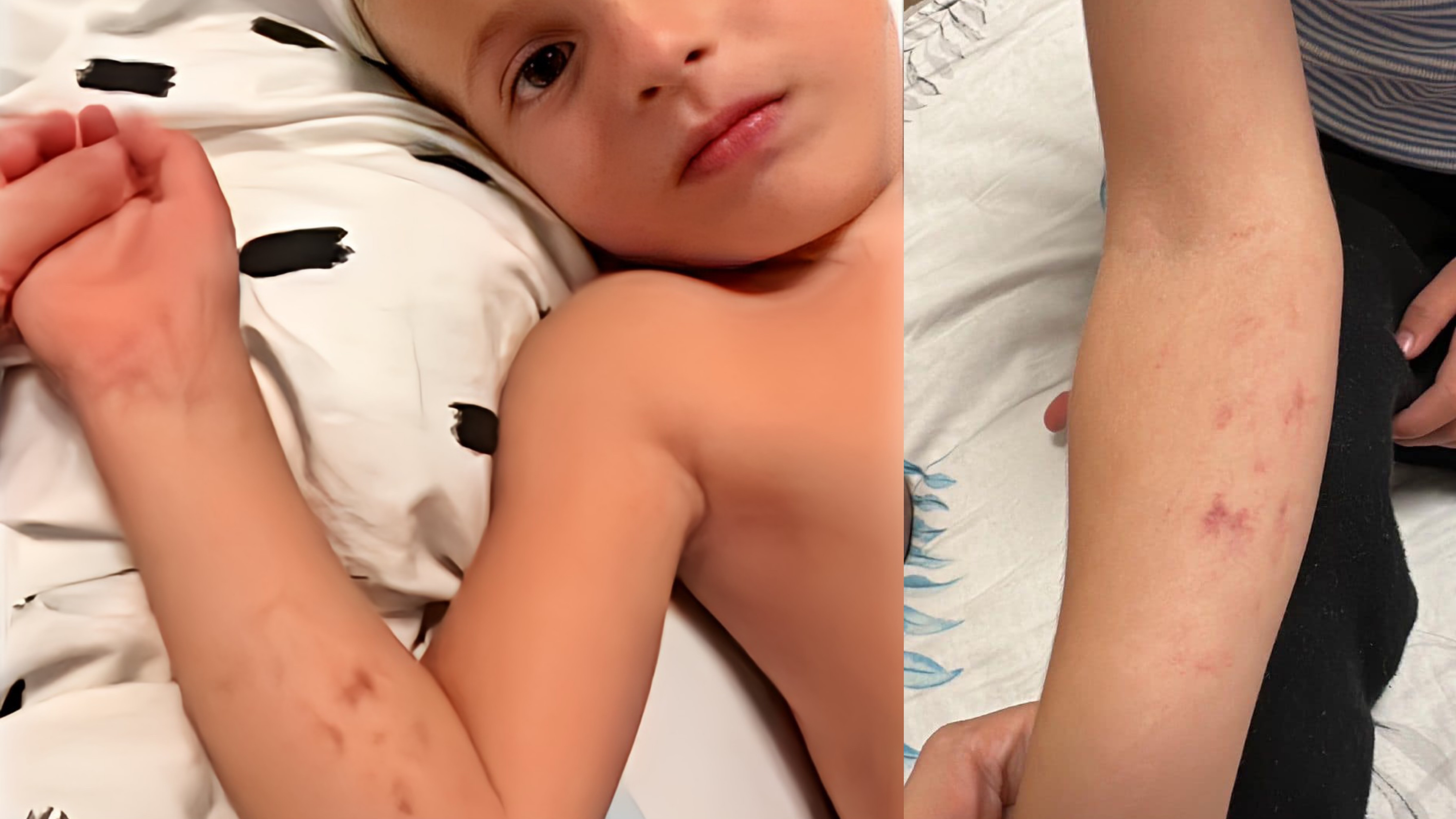 Edukatoret tërheqin zvarrë dhe dhunojnë 3-vjeçarin