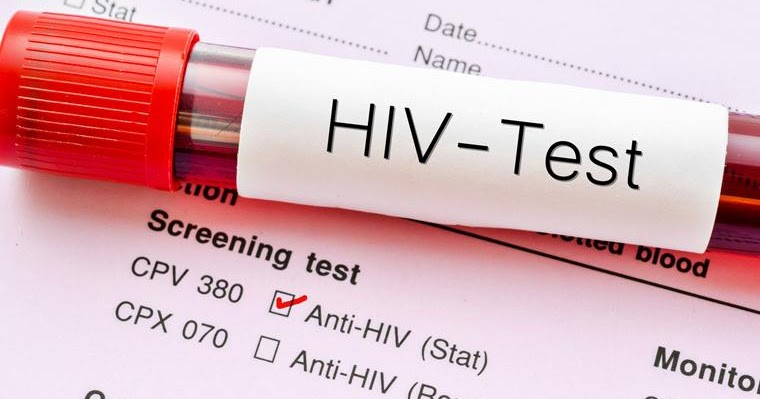 Këtë vit janë regjistruar 46 raste të reja me HIV/AIDS