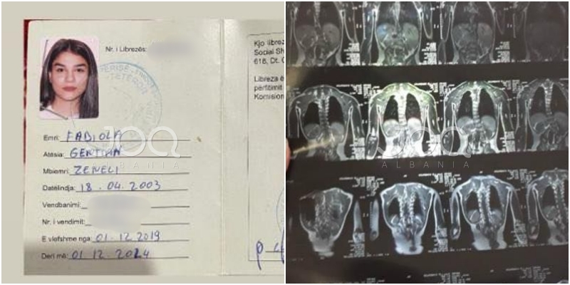 Fabiola kërkon ndihmën e shqiptarëve që të ecë sërish, dy operacionet i kushtojnë 22,800 €