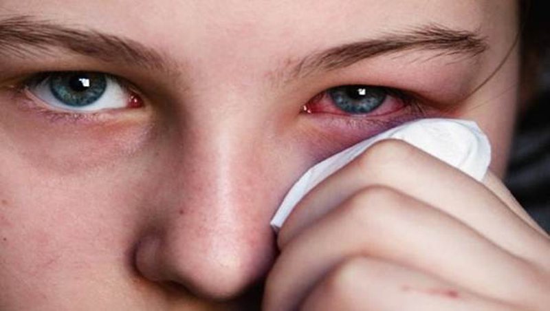Shtohen rastet e gripit të syrit te fëmijët, mjekët: Kujdes higjienën