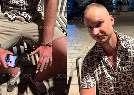 EKSKLUZIVE/ Turisti hungarez i gjakosur: Më rrahën rojet e Orange Club në Sarandë!