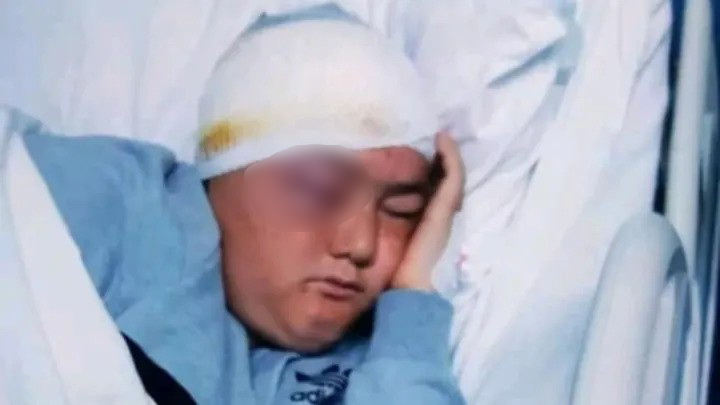 Po lufton prej vitesh me tumorin agresiv në tru, 25-vjeçari ka nevojë për ndihmën e shqiptarëve
