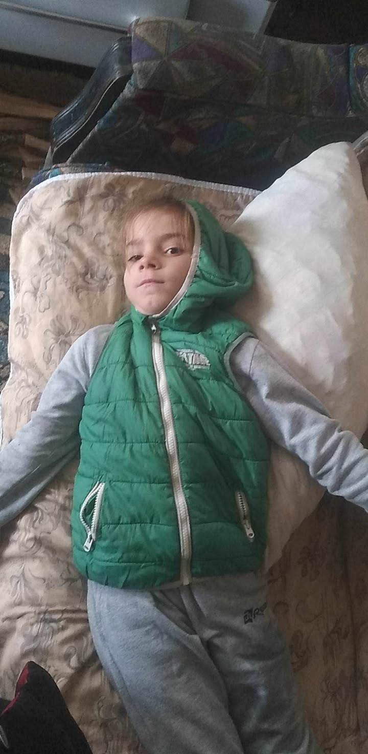 Vuan nga tumori në tru dhe epilepsia, vogëlushja 9-vjeçare ka nevojë urgjente për ndihmën e shqiptarëve