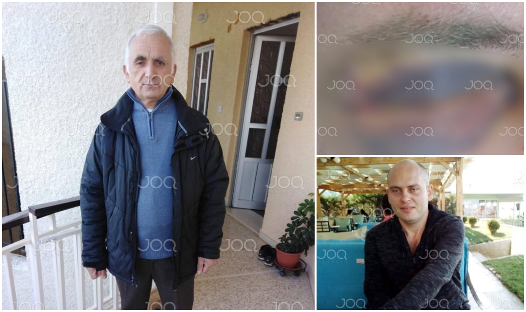 “Shoferi i drejtorit të Tatimeve me djemtë e tij dhunojnë brutalisht punonjësin e Illyrian Guard, policia mban të fshehtë ngjarjen”