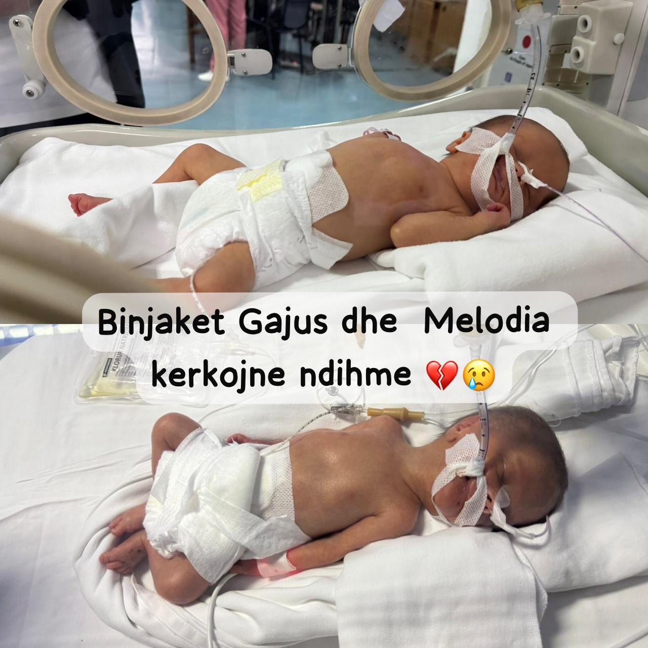 Gajus dhe Melodia kanë nevojë për ndihmë, të sapo lindur po luftojnë për jetën
