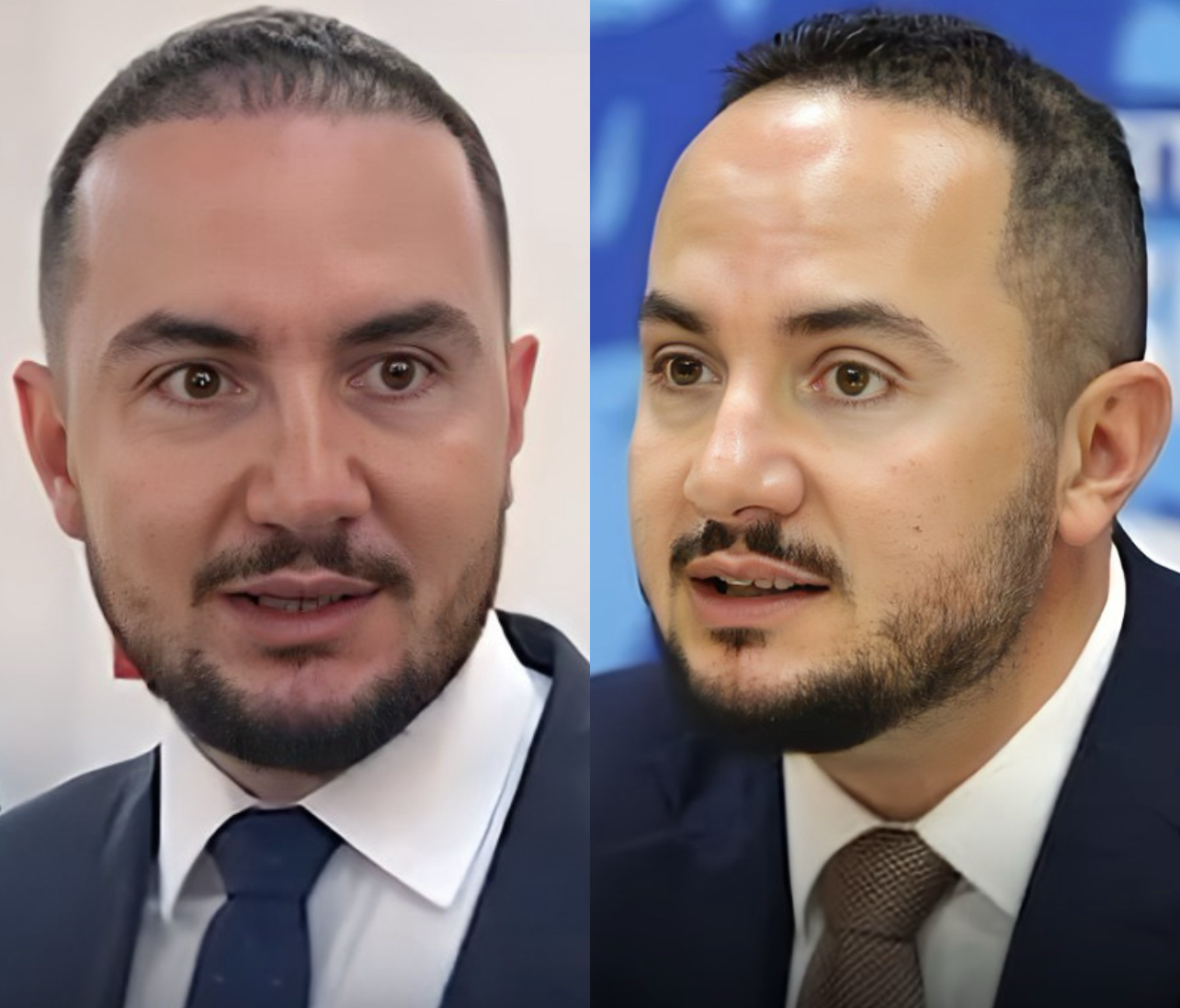 Ervin Salianji “rilind” në burg: Ish-deputeti mbjell flokët gjatë vuajtjes së dënimit