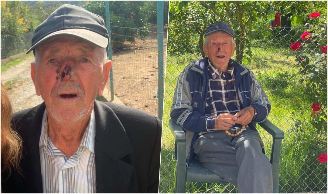 E ka parë kush gjysh Mersinin? Familja kërkon ndihmë për gjetjen e të moshuarit, ka probleme me kujtesën