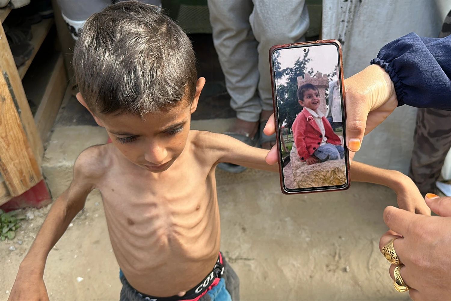 Situatë e mjerueshme në Gaza: foshnjat vdesin pa ushqim, fëmijët mbijetojnë në mbeturina