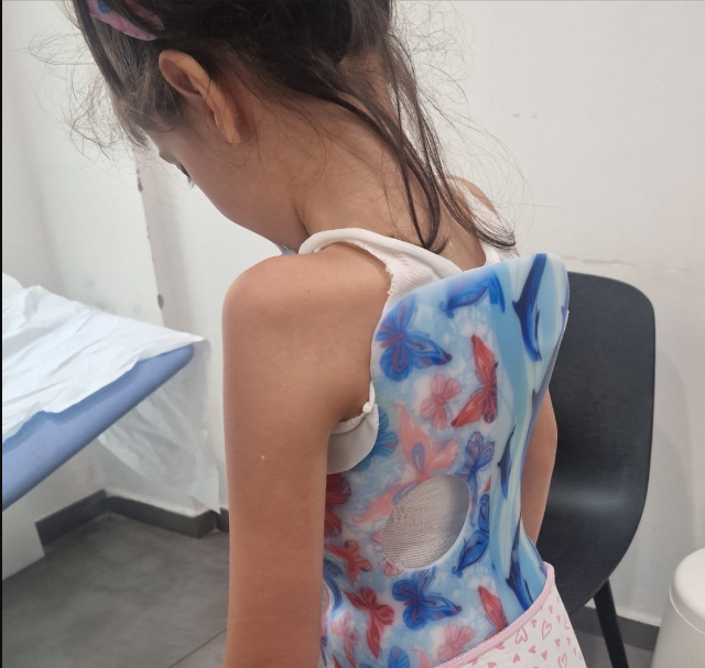 Vuan nga probleme të rënda të shtyllës kurrizore, Ajla e vogël ka nevojë për ndihmën e shqiptarëve