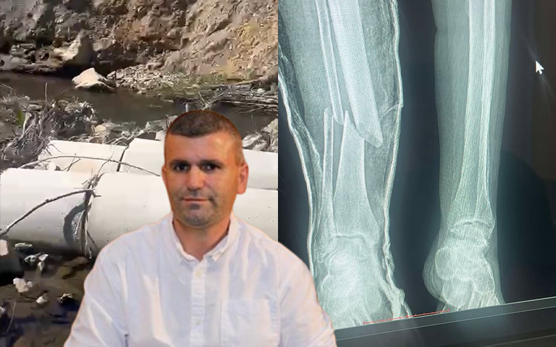 Bashkia nuk mori masa, kuksiani thyen këmbën në rrugën e amortizuar të fshatit Shtrez