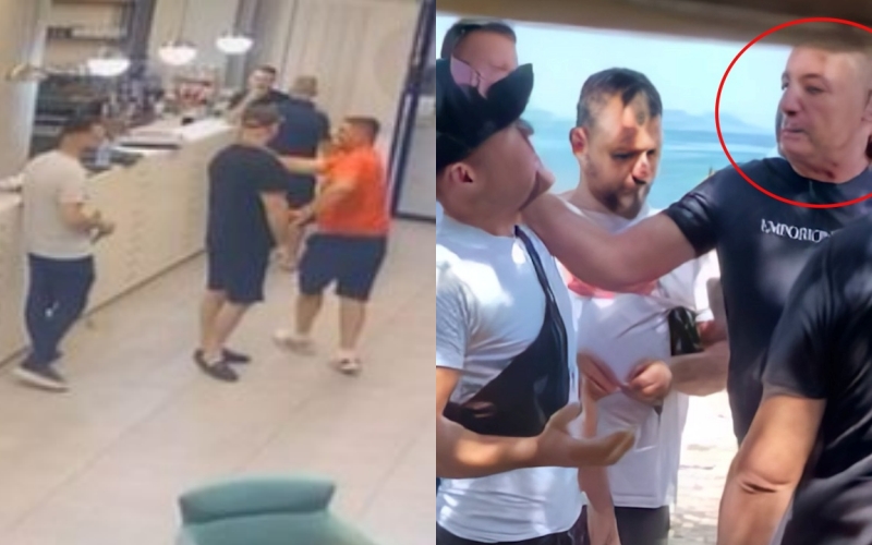 Bedinaj bën për spital policin që dhunoi kamarierin