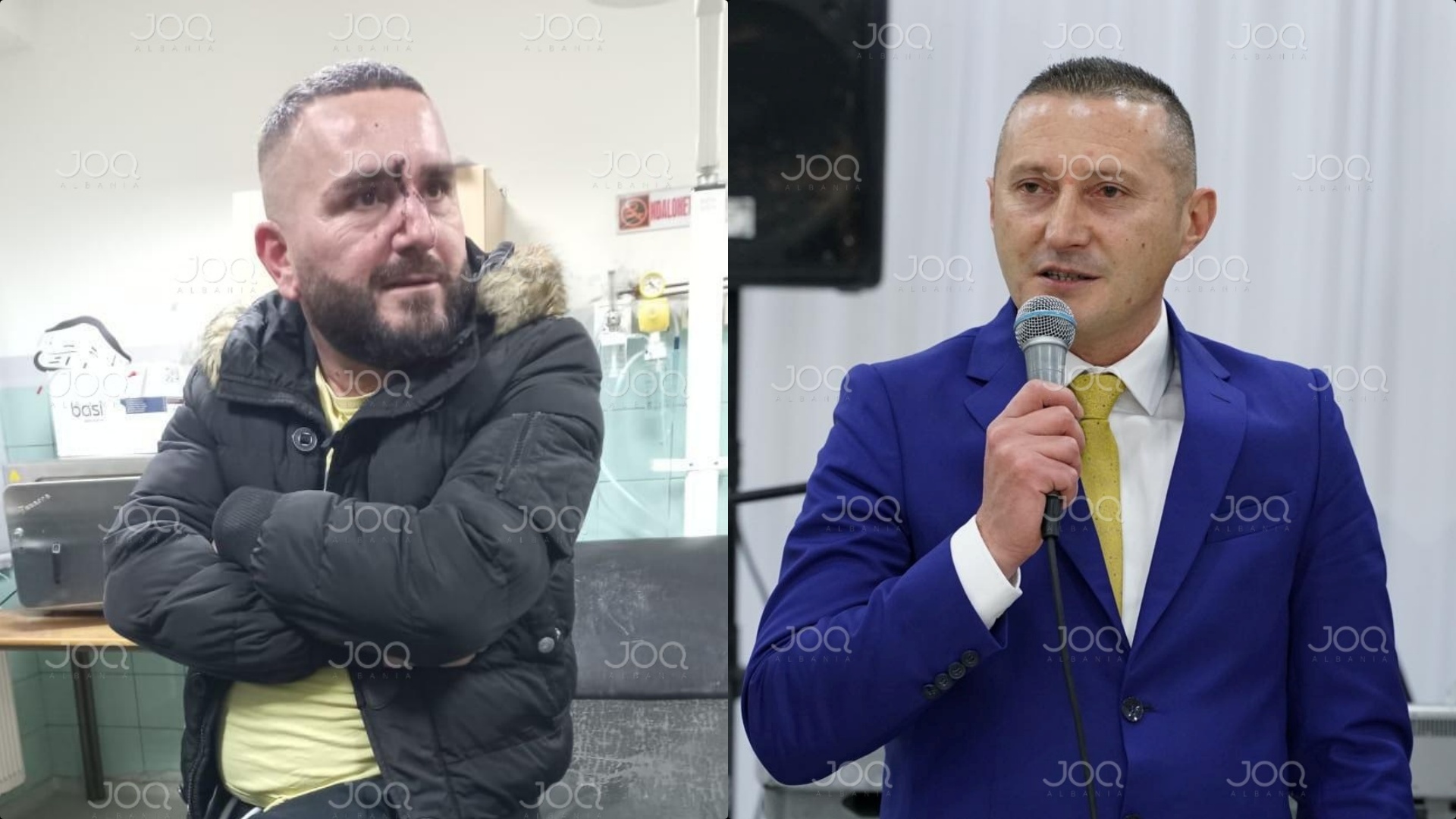 Komisariati i Rrëshenit plot me policë boksierë! Qytetari: Më rrahën, do bëj vetëgjyqsi