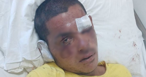 18-vjeçari përfundon i gjymtuar pas aksidentit: Shoferi ikën, askush nuk kujdeset për të