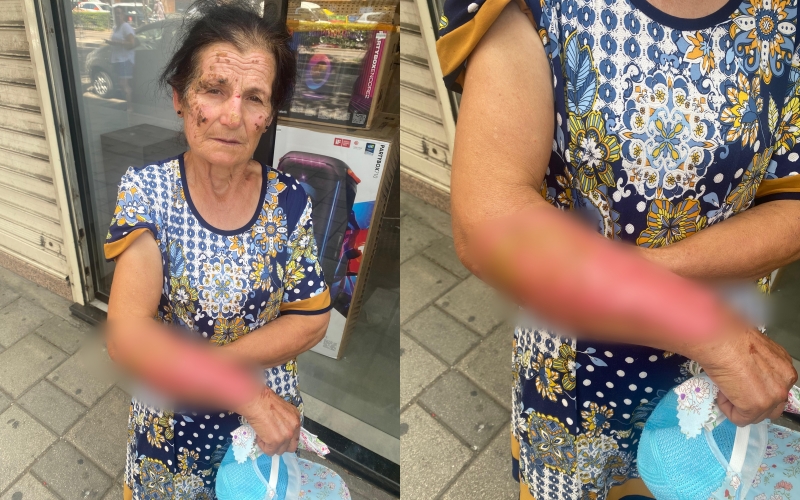 Në kushte jo të mira jetese  nëna Zelihe kërkon ndihmë nga shqiptarët