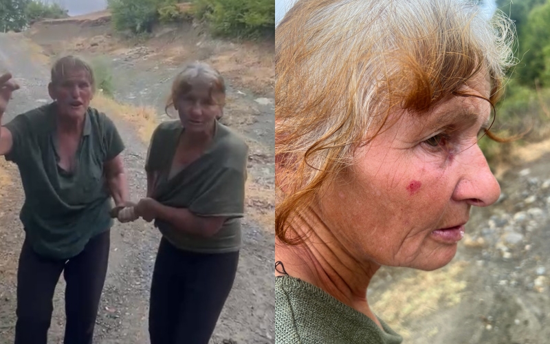Gruaja sulmon dhe akuzon pa fakte fqinjen në fshatin Midhe, policia nuk merr masa