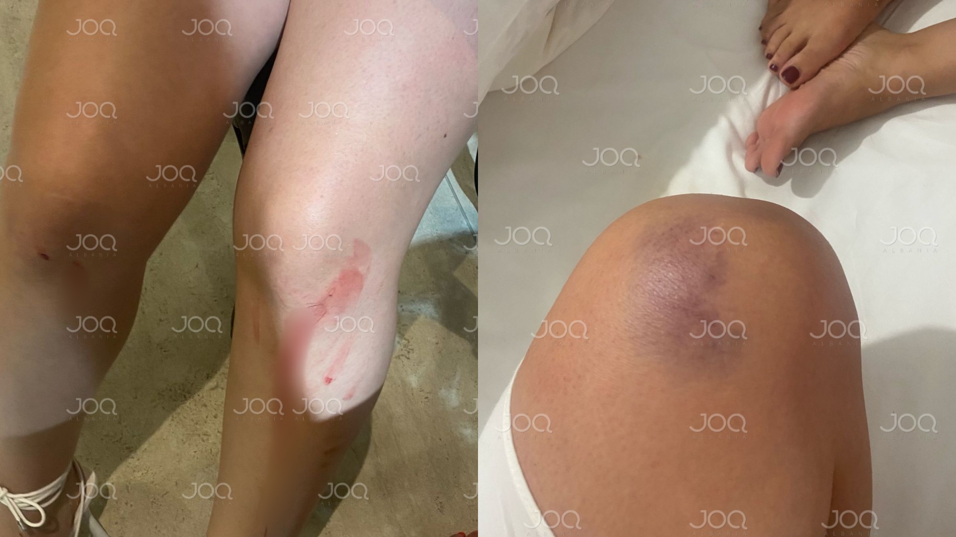 ‘Për pak pësova atak paniku’, dëshmitarja rrëfen tmerrin e perjetuar në ‘Lolipop’