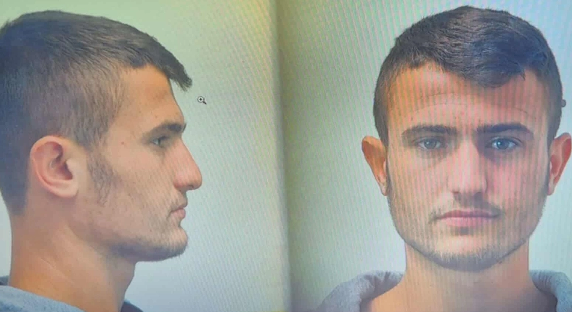 U arrestua me këmbë të thyer, arratiset nga spitali shqiptari në Greqi