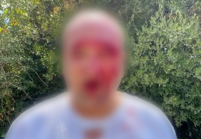 Dhunohet operatori i një guide turistike polake në Përmet