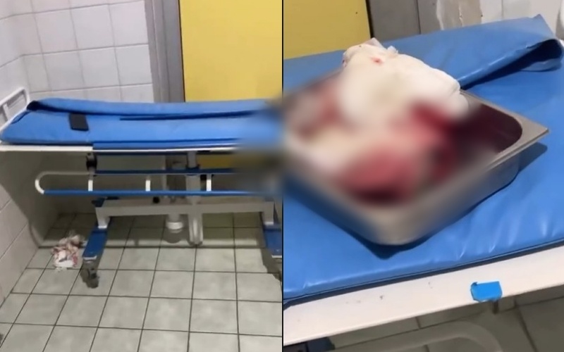 Materniteti i Shkodrës pa asnjë standard pastërtie, rrezik për nënat dhe foshnjet