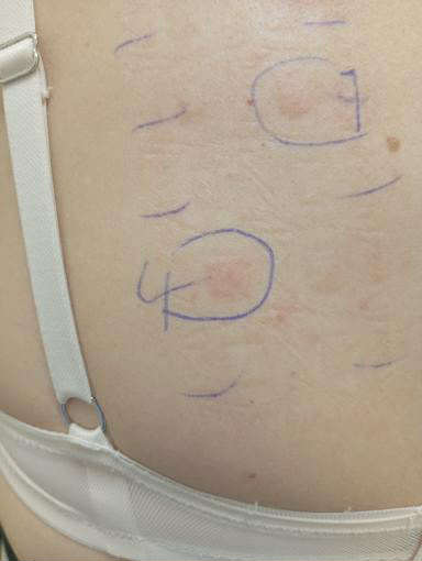 “U sëmura nga produktet e thonjve në sallon!”