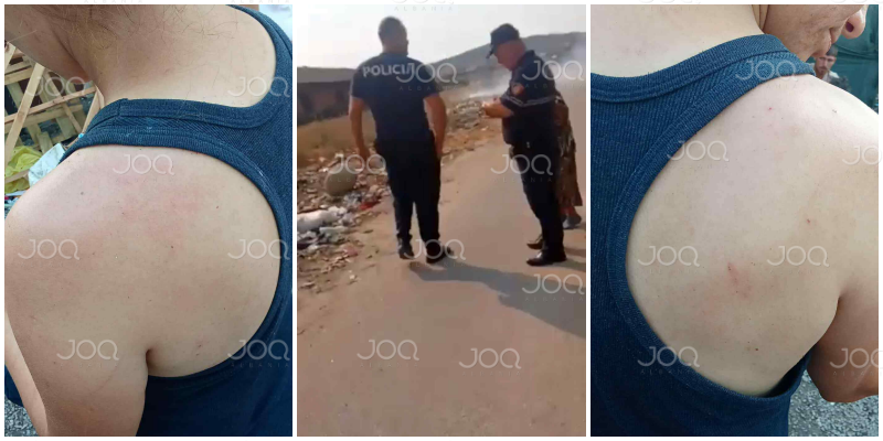 “Qysh e rrafe ti atë”, banorët përplasen me policinë: Dhunuan nënën e 4 fëmijëve pa arsye