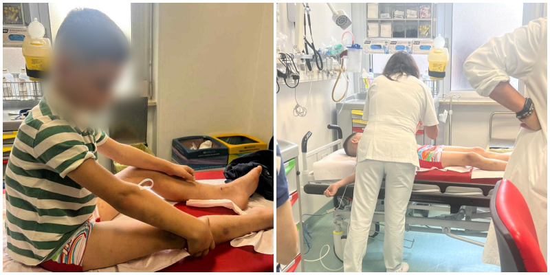 “Amaneti u krye!” Vëllai 10-vjeçar i motrave Dhimaku nis kurimin në Itali falë “Fondacionit Firdeus”