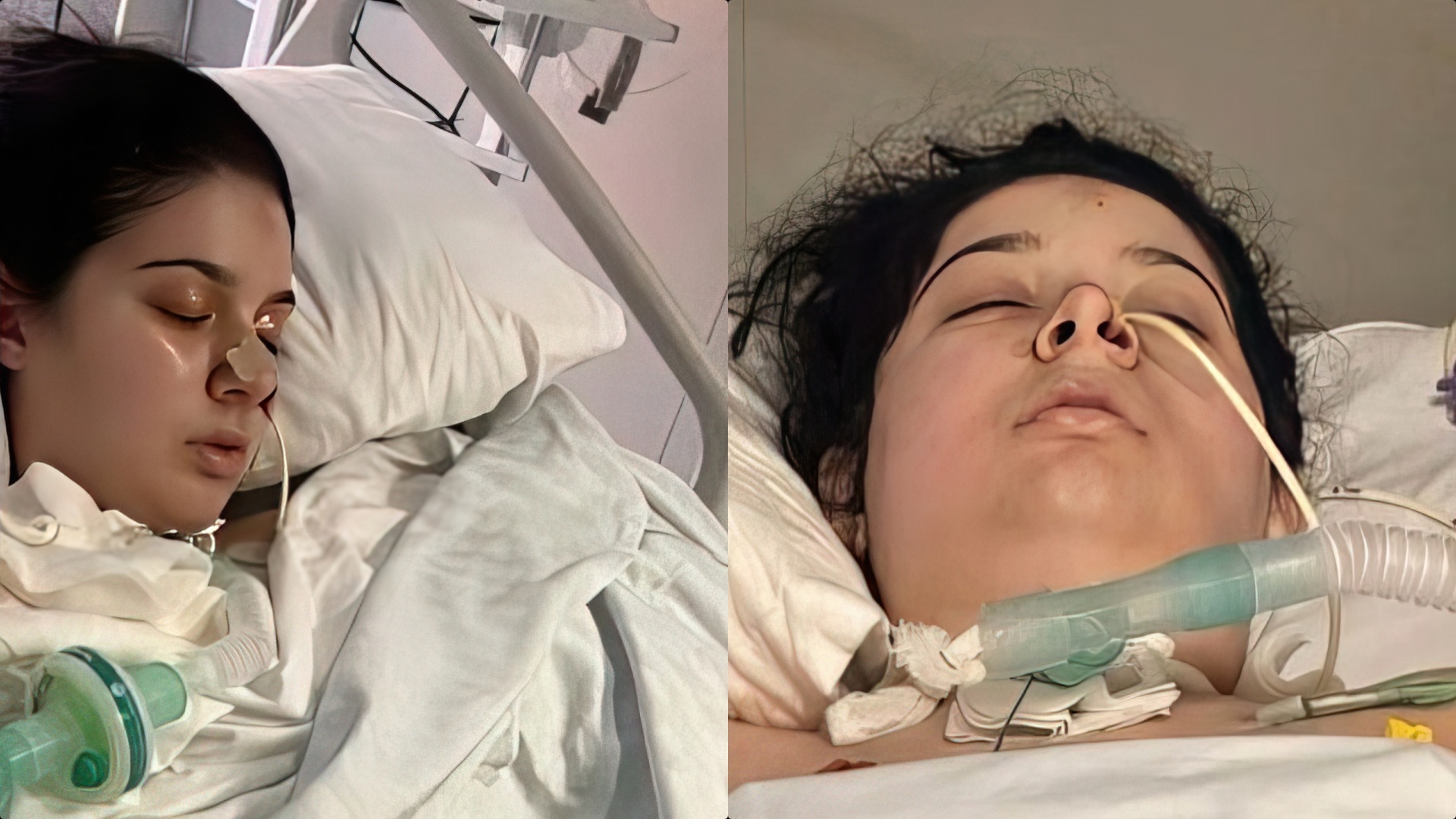 Falë shqiptarëve Rozalinda ka një shans për t’u shëruar