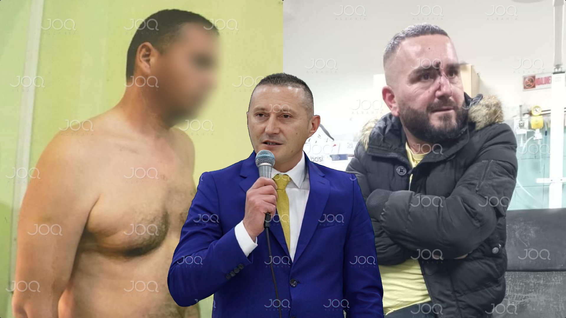 Edhe biznesmeni i ra me kokë murit?! Denoncim për shefin ‘boksier’ Klodian Kondi