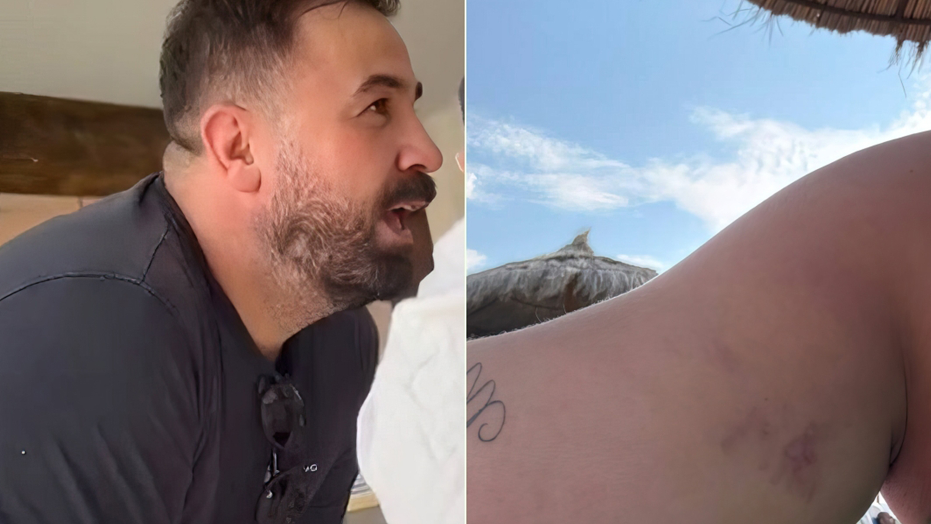 Pronari i hotel “Scandinavia” në Ulqin sulmon dhe ofendon pushueset nga Kosova